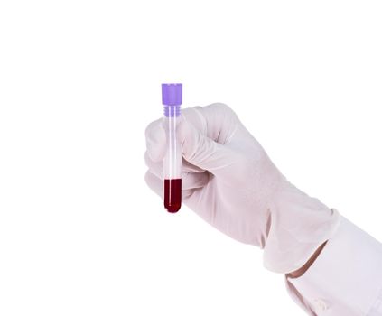 Hand holding test tube with blood isolated on white background