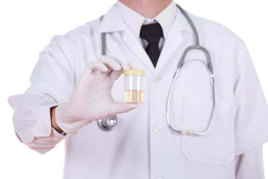 doctor's hand holding a bottle of urine sample