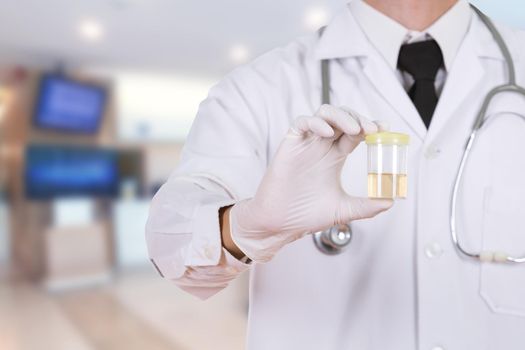 doctor's hand holding a bottle of urine sample in hospital background