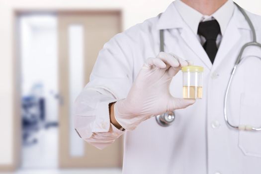 doctor's hand holding a bottle of urine sample in hospital background