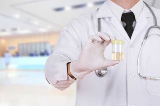 doctor's hand holding a bottle of urine sample in hospital background