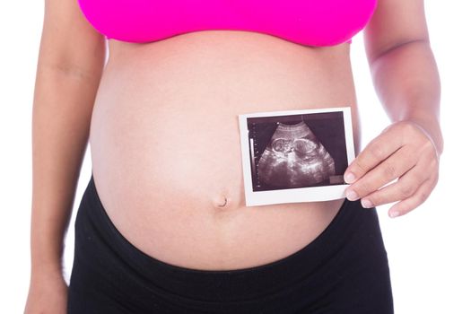 Pregnant woman hands holding ultrasound photo isolated on white background