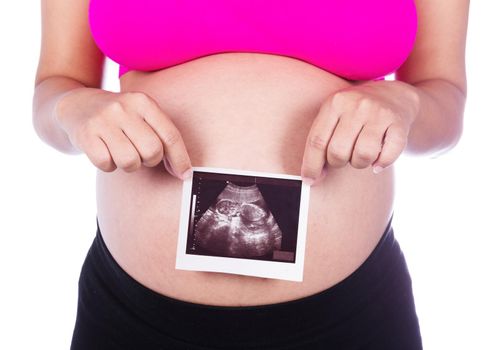 Pregnant woman hands holding ultrasound photo isolated on white background