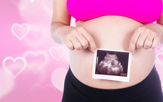 Pregnant woman hands holding ultrasound photo isolated on heart backrground