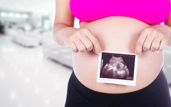 Pregnant woman hands holding ultrasound photo isolated in hospital background