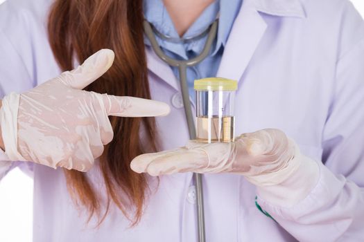 female doctor's hand holding a bottle of urine sample 