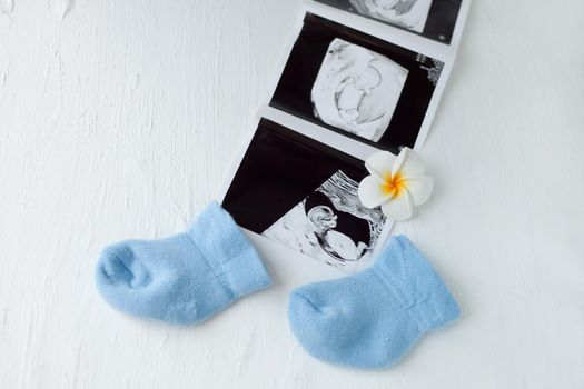 Child health. Baby boy blue socks with ultrasound tests images - pregnancy care and maternity concept.