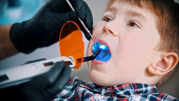 A little boy having his tooth done in the dentistry - putting the photopolymer lamp with blue light in the mouth to set the seal. Mid shot