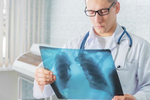 Male doctor looks at x-ray picture of lungs in a clinic