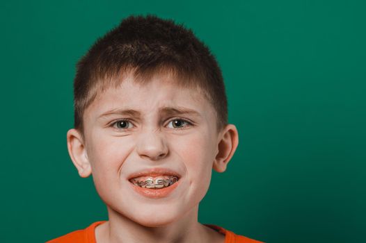 A boy of Caucasian nationality demonstrates a plate for straightening crooked and deformed teeth. new