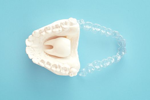 Orthodontic dental theme on blue  background.Transparent invisible dental aligners or braces aplicable for an orthodontic dental treatment