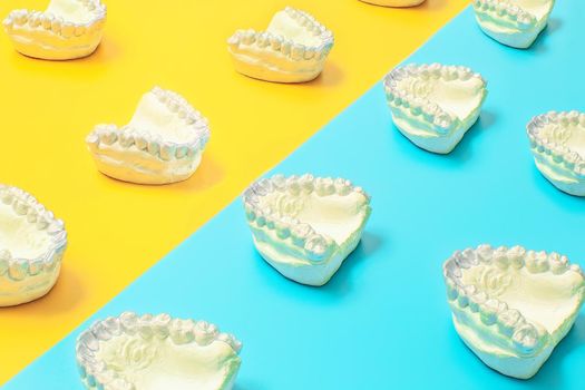 Orthodontic dental theme on blue and yellow background.Transparent invisible dental aligners or braces aplicable for an orthodontic dental treatment