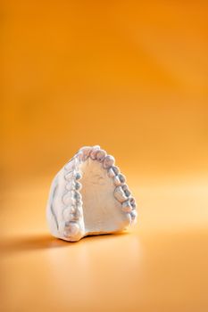 Inivisalign braces or aligner. A way to have a beautiful smile and white teeth.Invisible Invisalign plastic dental teeth brackets