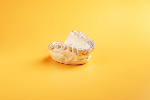 Close-up individual tooth tray Orthodontic dental theme. In hand Invisible braces