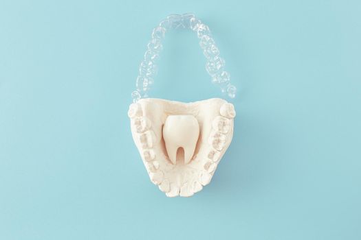 Orthodontic dental theme on blue  background.Transparent invisible dental aligners or braces aplicable for an orthodontic dental treatment
