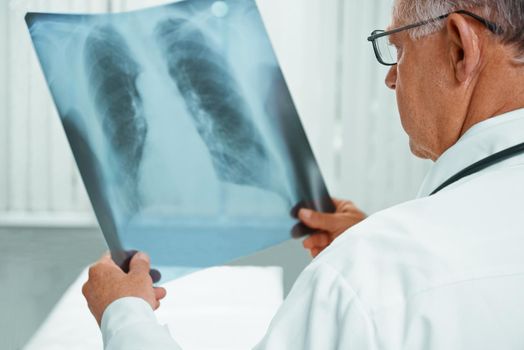 Unrecognizable older man doctor is analyzing x-ray image of lungs in a clinic