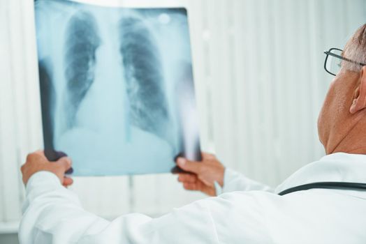 Unrecognizable older man doctor examines x-ray image of lungs in a clinic