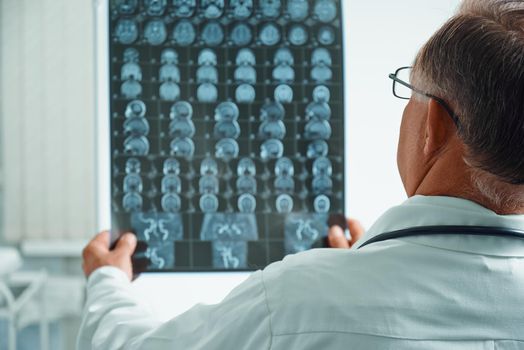 Unrecognizable senior man doctor examines MRI image of human head in hospital