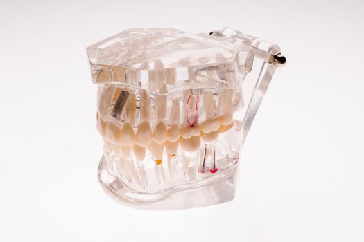 Transparent dentures jaw layout on a white background - image