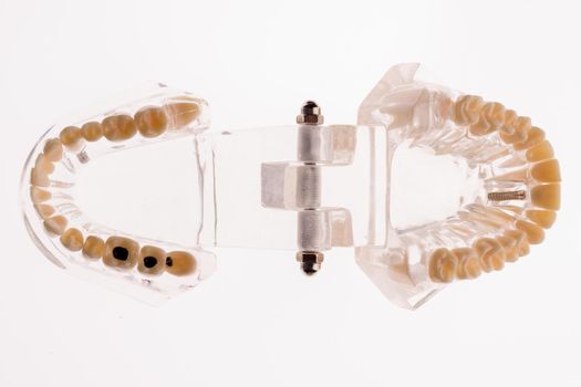 Transparent dentures jaw layout on a white background - image