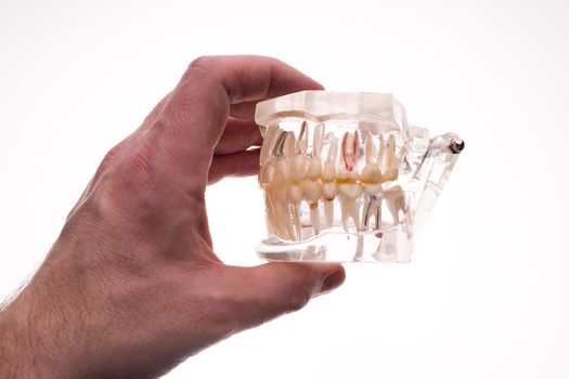 Dentist holding dentures jaw layout on a white background - image