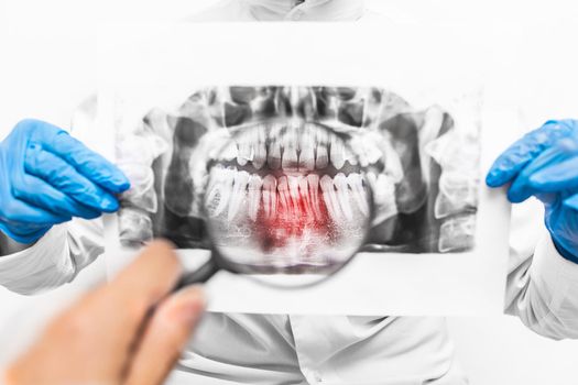 The dentist's hands in blue latex medical gloves hold a x-ray shot of the mouth and examine it using a magnifying glass, close-up.