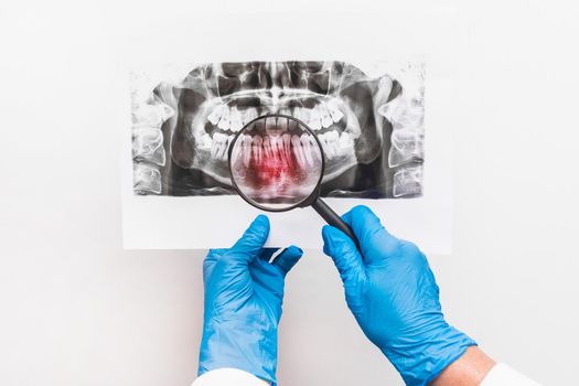 A doctor in protective medical gloves holds an X-ray picture of teeth in her hands and examines it through a magnifying glass on a white background, close up.