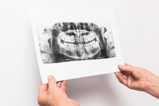 Doctor's hands are holding and examining an x-ray picture of teeth on a white background in medical office.