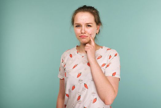 Portrait of teen girl touching her face and looking for acne on blue background
