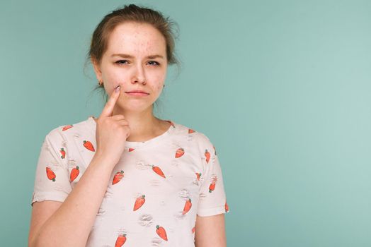 Portrait of teen girl touching her face and looking for acne on blue background