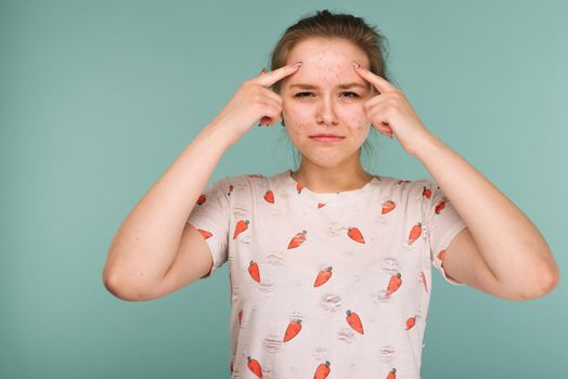 Portrait of teen girl touching her face and looking for acne on blue background