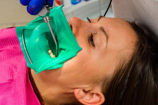 The dentist installs a rubber dam, sterile dental treatment, modern equipment in dentistry.2020