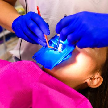 Treatment of the upper sixth left tooth, sterile treatment with roofing felt. new