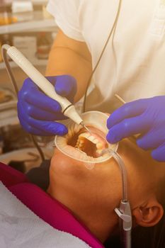 The dentist removes tartar using ultrasound, the patient at the dentist. Retractor for isolation of lips and gums. 2020