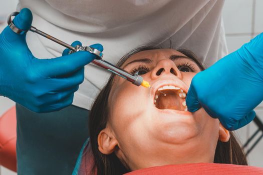 The dentist with the help of a carpule syringe injects anesthesia into the patient's gums, local anesthesia.2020