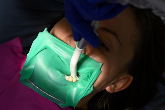 A woman at a dentist's appointment, a dentist uses a rubber dam and dental tools for treatment.2020