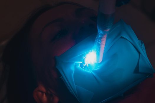 Ultraviolet light in dentistry, treatment of upper masticatory teeth. new