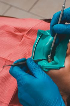 The dentist installs a rubber dam, sterile dental treatment, modern equipment in dentistry.2020