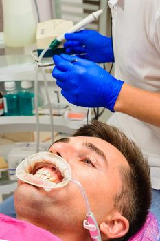 The procedure at the dentist,the dentist prepares the patient and tools to remove tartar, saliva ejector and retractor in the patient's mouth.2020