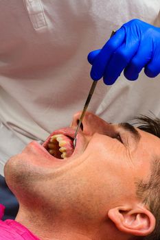 Visiting the dentist, the dentist evaluates the oral cavity and identifies problem areas of the teeth. Fistula mouth.