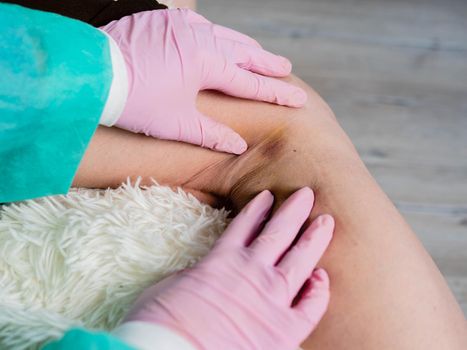 Close-up of physiotherapist treating knee after injury