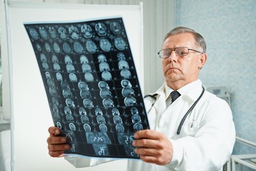 Senior man doctor examines MRI image of human head in hospital