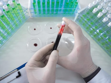 Photo of diseased blood sample in a test tube in a researcher's hands. Vaccine creation. View from a researcher's eyes.