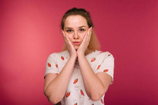 Portrait of teen girl touching her face and looking for acne on ruby background