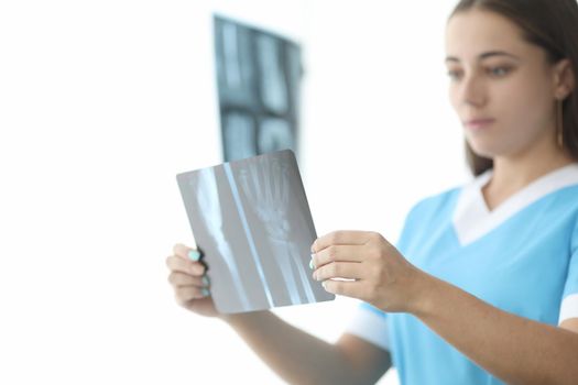 Traumatologist doctor looking at xray of hand in clinic closeup. Diagnosis and treatment of rheumatoid arthritis concept