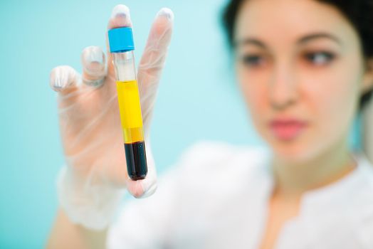 Medical cosmetology blood plasma in vitro keeps the doctor