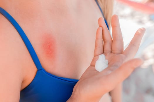 The hand of a young girl in a blue swimsuit with sunscreen next to her chest and shoulder.