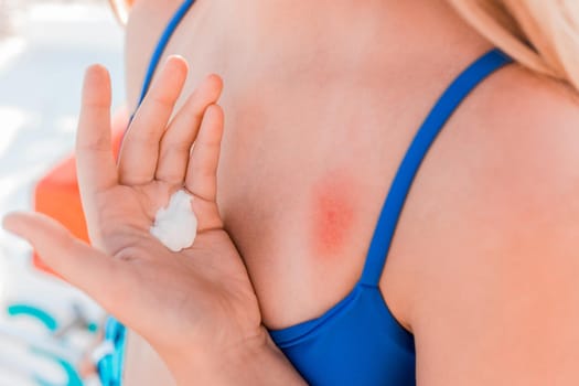 The hand of a young girl in a blue swimsuit with sunscreen next to her chest and shoulder.