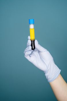 Hand holding extraction of plasma from blood in test tube