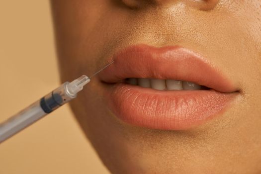 Close up shot of cosmetic injection to the lips of young woman isolated over beige background. Beauty, cosmetology concept. Horizontal shot